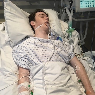 Photo of 17-year-old Liam, intubated in hospital following misdiagnosed meningitis